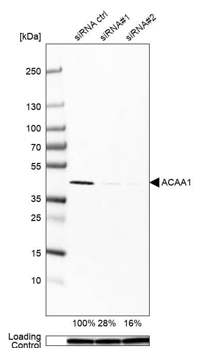 ACAA1 Antibody (CL2650) - Azide and BSA Free Western Blot: ACAA1 Antibody [NBP3-44444]