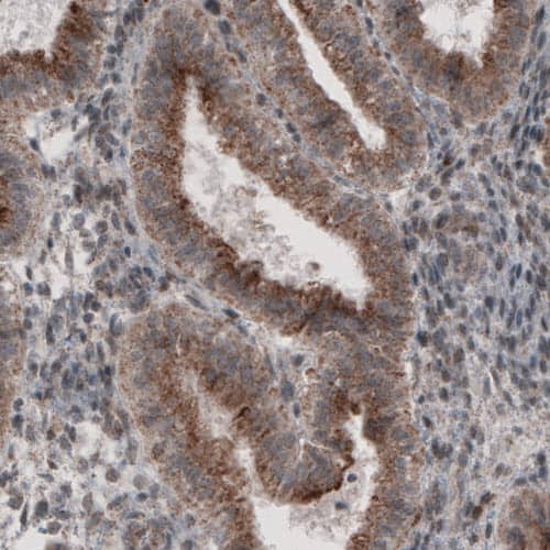 ACAA1 Antibody (CL2662) - Azide and BSA Free Immunohistochemistry-Paraffin: ACAA1 Antibody [NBP3-44445]