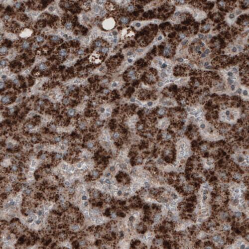 ACAA1 Antibody (CL2662) - Azide and BSA Free Immunohistochemistry-Paraffin: ACAA1 Antibody [NBP3-44445]