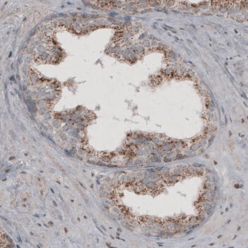 ACAA1 Antibody (CL2662) - Azide and BSA Free Immunohistochemistry-Paraffin: ACAA1 Antibody [NBP3-44445]