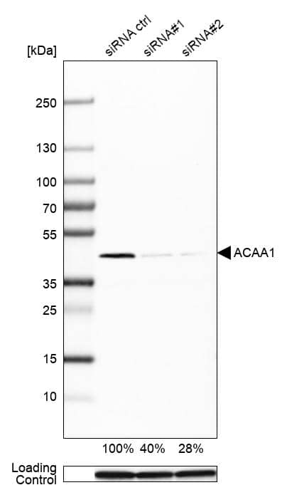 ACAA1 Antibody (CL2662) - Azide and BSA Free Western Blot: ACAA1 Antibody [NBP3-44445]