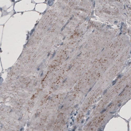 ACAA1 Antibody (CL2662) - Azide and BSA Free Immunohistochemistry-Paraffin: ACAA1 Antibody [NBP3-44445]