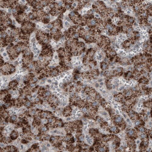 ACAA1 Antibody (CL2663) - Azide and BSA Free Immunohistochemistry-Paraffin: ACAA1 Antibody [NBP3-44446]