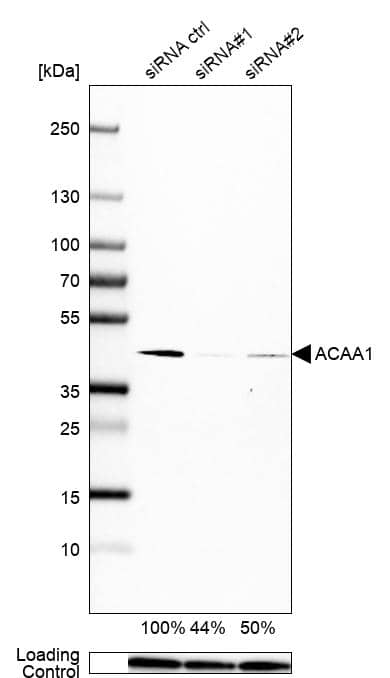ACAA1 Antibody (CL2663) - Azide and BSA Free Western Blot: ACAA1 Antibody [NBP3-44446]