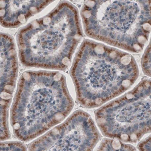 ACAA1 Antibody (CL2663) - Azide and BSA Free Immunohistochemistry-Paraffin: ACAA1 Antibody [NBP3-44446]