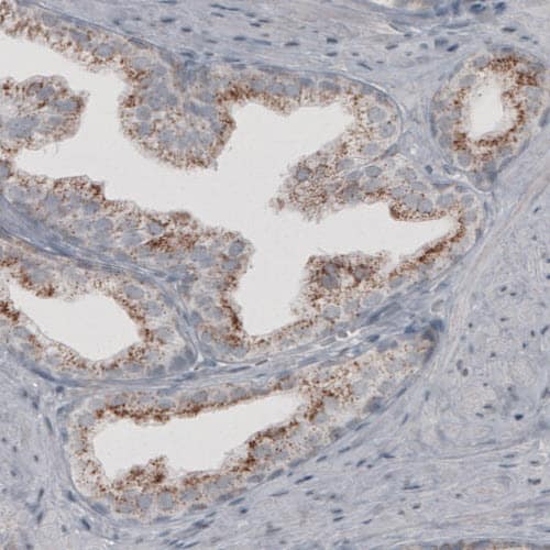 ACAA1 Antibody (CL2663) - Azide and BSA Free Immunohistochemistry-Paraffin: ACAA1 Antibody [NBP3-44446]
