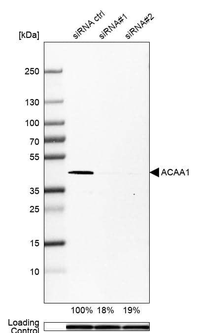 ACAA1 Antibody (CL2660) - Azide and BSA Free Western Blot: ACAA1 Antibody [NBP3-44447]