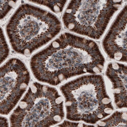 ACAA1 Antibody (CL2660) - Azide and BSA Free Immunohistochemistry-Paraffin: ACAA1 Antibody [NBP3-44447]