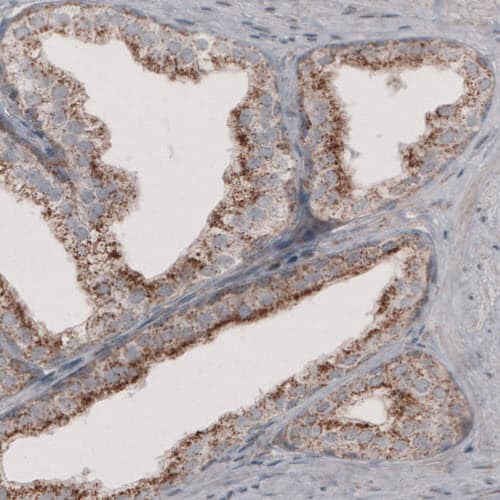 ACAA1 Antibody (CL2660) - Azide and BSA Free Immunohistochemistry-Paraffin: ACAA1 Antibody [NBP3-44447]