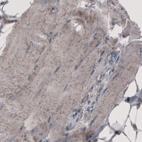 ACAA1 Antibody (CL2660) - Azide and BSA Free Immunohistochemistry-Paraffin: ACAA1 Antibody [NBP3-44447]