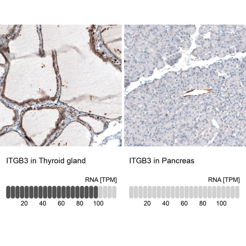 Integrin beta 3/CD61 Antibody (CL7319) - Azide and BSA Free Immunohistochemistry-Paraffin: Integrin beta 3/CD61 Antibody [NBP3-44448]