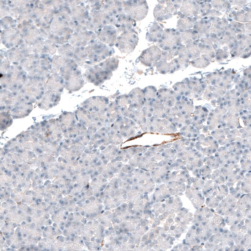 Integrin beta 3/CD61 Antibody (CL7319) - Azide and BSA Free Immunohistochemistry-Paraffin: Integrin beta 3/CD61 Antibody [NBP3-44448]