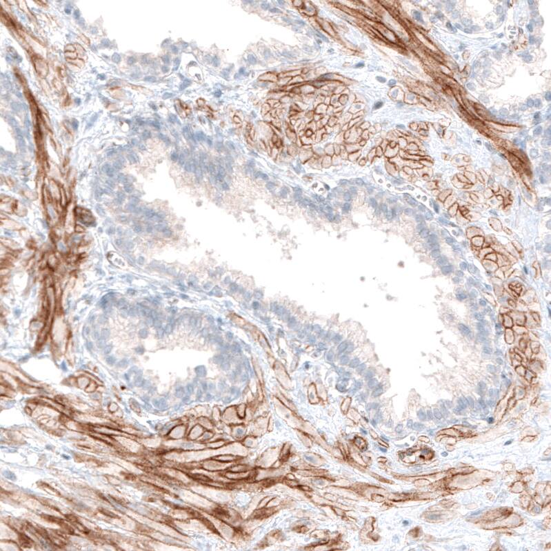 Integrin beta 3/CD61 Antibody (CL7319) - Azide and BSA Free Immunohistochemistry-Paraffin: Integrin beta 3/CD61 Antibody [NBP3-44448]