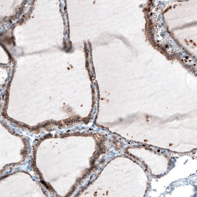 Integrin beta 3/CD61 Antibody (CL7319) - Azide and BSA Free Immunohistochemistry-Paraffin: Integrin beta 3/CD61 Antibody [NBP3-44448]