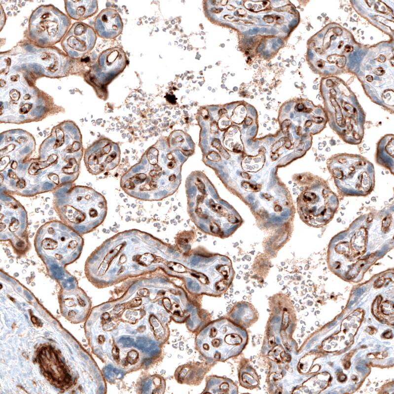Integrin beta 3/CD61 Antibody (CL7319) - Azide and BSA Free Immunohistochemistry-Paraffin: Integrin beta 3/CD61 Antibody [NBP3-44448]
