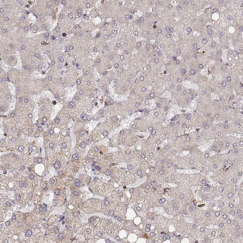 CS Citrate Synthase Antibody (CL2545) - Azide and BSA Free Immunohistochemistry-Paraffin: CS Citrate Synthase Antibody [NBP3-44449]