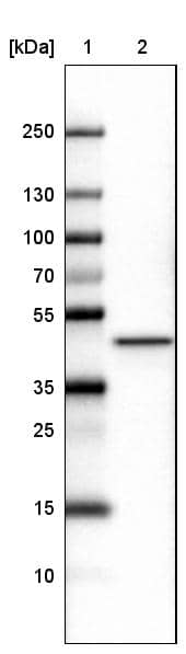 CS Citrate Synthase Antibody (CL2548) - Azide and BSA Free Western Blot: CS Citrate Synthase Antibody [NBP3-44450]