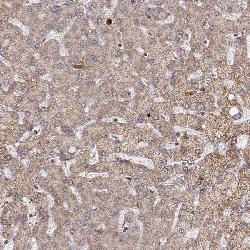 CS Citrate Synthase Antibody (CL2548) - Azide and BSA Free Immunohistochemistry-Paraffin: CS Citrate Synthase Antibody [NBP3-44450]