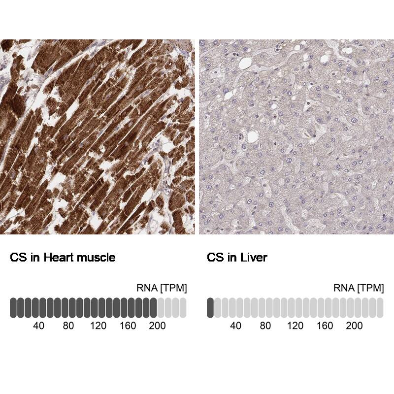 CS Citrate Synthase Antibody (CL2553) - Azide and BSA Free Immunohistochemistry-Paraffin: CS Citrate Synthase Antibody [NBP3-44451]