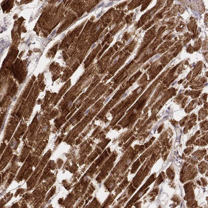 CS Citrate Synthase Antibody (CL2553) - Azide and BSA Free Immunohistochemistry-Paraffin: CS Citrate Synthase Antibody [NBP3-44451]