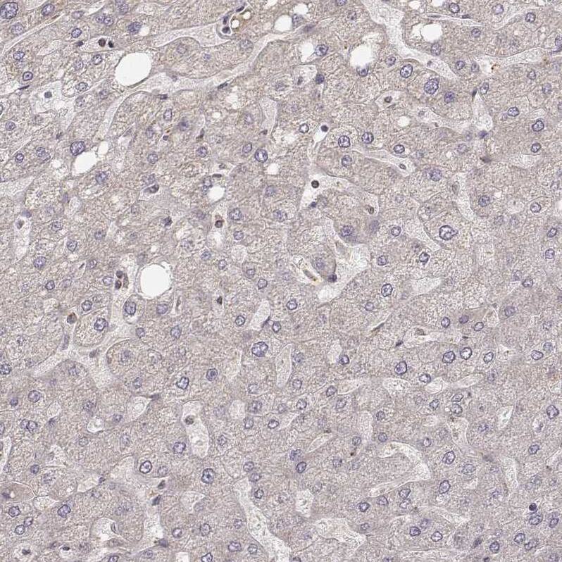 CS Citrate Synthase Antibody (CL2553) - Azide and BSA Free Immunohistochemistry-Paraffin: CS Citrate Synthase Antibody [NBP3-44451]