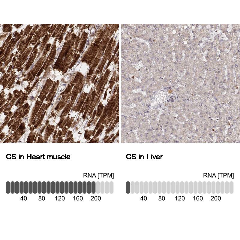 CS Citrate Synthase Antibody (CL2561) - Azide and BSA Free Immunohistochemistry-Paraffin: CS Citrate Synthase Antibody [NBP3-44452]