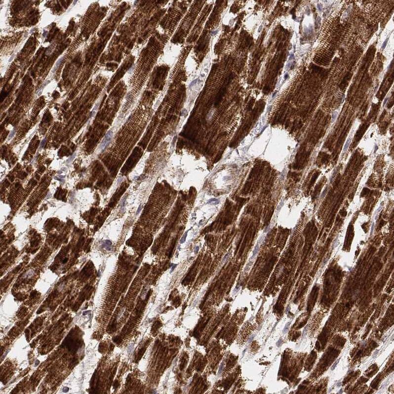 CS Citrate Synthase Antibody (CL2561) - Azide and BSA Free Immunohistochemistry-Paraffin: CS Citrate Synthase Antibody [NBP3-44452]