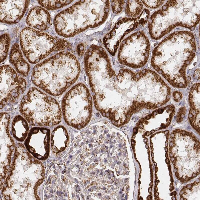 CS Citrate Synthase Antibody (CL2561) - Azide and BSA Free Immunohistochemistry-Paraffin: CS Citrate Synthase Antibody [NBP3-44452]