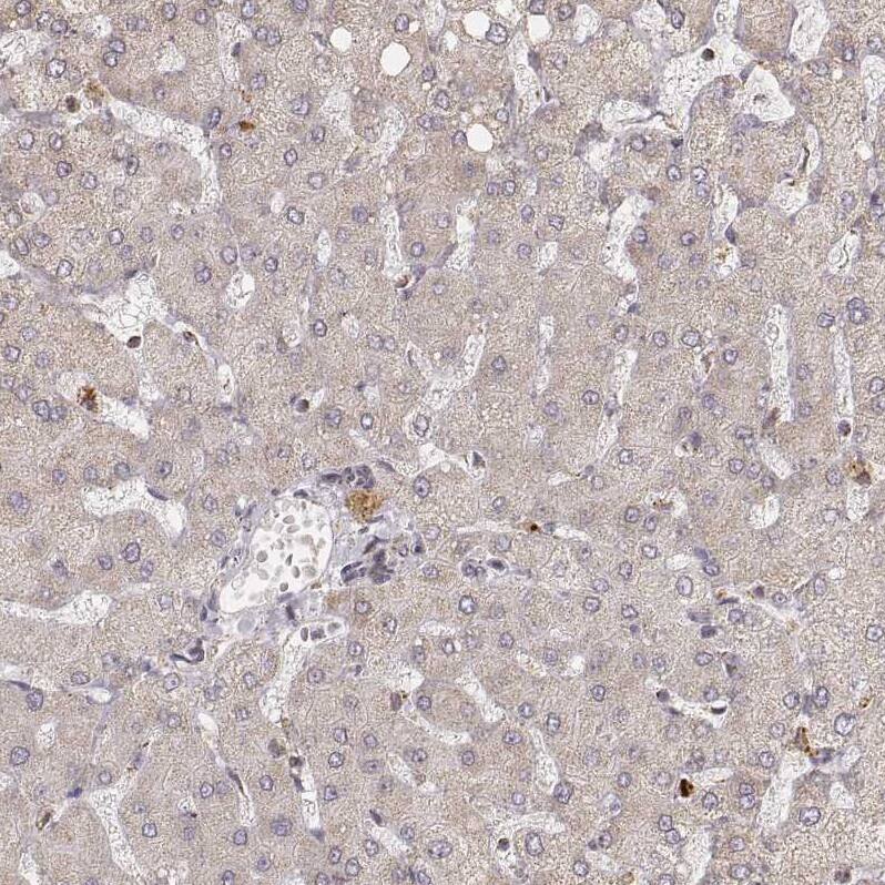 CS Citrate Synthase Antibody (CL2561) - Azide and BSA Free Immunohistochemistry-Paraffin: CS Citrate Synthase Antibody [NBP3-44452]