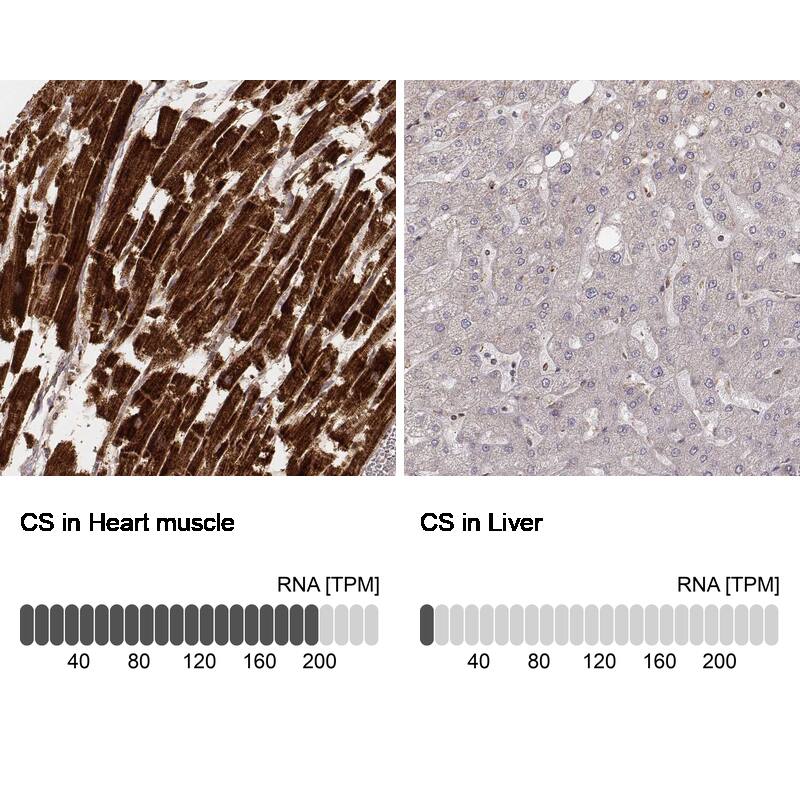 CS Citrate Synthase Antibody (CL2579) - Azide and BSA Free Immunohistochemistry-Paraffin: CS Citrate Synthase Antibody [NBP3-44453]