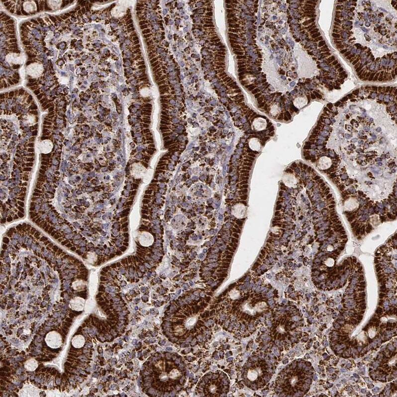CS Citrate Synthase Antibody (CL2579) - Azide and BSA Free Immunohistochemistry-Paraffin: CS Citrate Synthase Antibody [NBP3-44453]