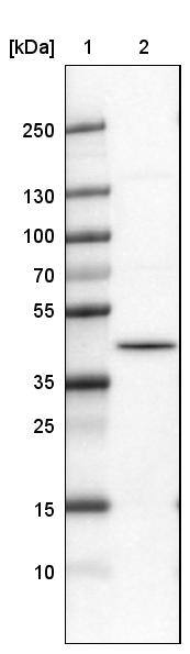hnRNP C1 + C2 Antibody (CL2596) - Azide and BSA Free Western Blot: hnRNP C1 + C2 Antibody [NBP3-44454]