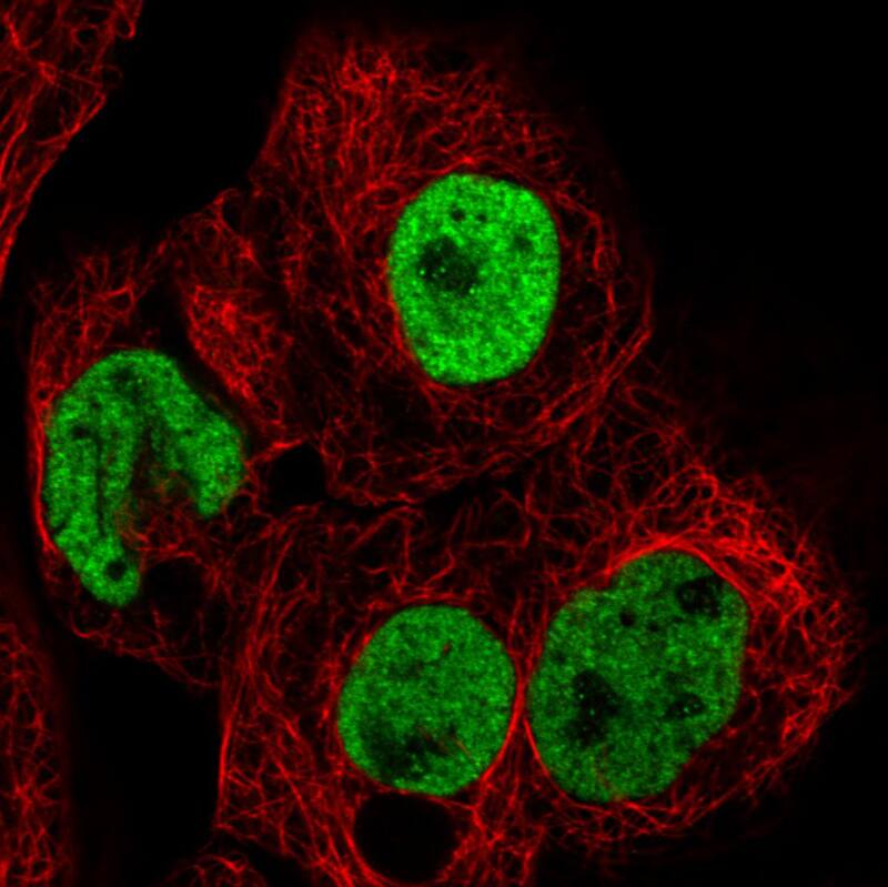 hnRNP C1 + C2 Antibody (CL2596) - Azide and BSA Free Immunocytochemistry/ Immunofluorescence: hnRNP C1 + C2 Antibody [NBP3-44454]