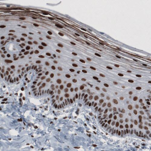 hnRNP C1 + C2 Antibody (CL2596) - Azide and BSA Free Immunohistochemistry-Paraffin: hnRNP C1 + C2 Antibody [NBP3-44454]