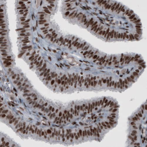 hnRNP C1 + C2 Antibody (CL2596) - Azide and BSA Free Immunohistochemistry-Paraffin: hnRNP C1 + C2 Antibody [NBP3-44454]