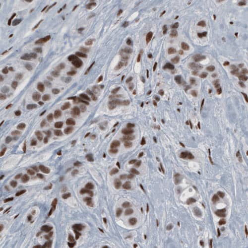 hnRNP C1 + C2 Antibody (CL2596) - Azide and BSA Free Immunohistochemistry-Paraffin: hnRNP C1 + C2 Antibody [NBP3-44454]