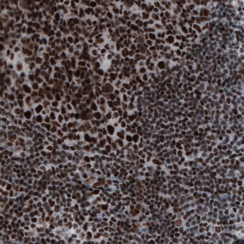 hnRNP C1 + C2 Antibody (CL2596) - Azide and BSA Free Immunohistochemistry-Paraffin: hnRNP C1 + C2 Antibody [NBP3-44454]