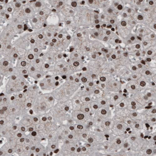 hnRNP C1 + C2 Antibody (CL2596) - Azide and BSA Free Immunohistochemistry-Paraffin: hnRNP C1 + C2 Antibody [NBP3-44454]