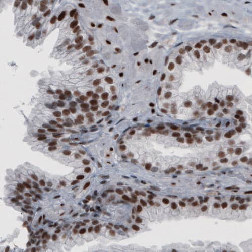 hnRNP C1 + C2 Antibody (CL2596) - Azide and BSA Free Immunohistochemistry-Paraffin: hnRNP C1 + C2 Antibody [NBP3-44454]