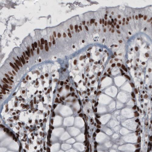 hnRNP C1 + C2 Antibody (CL2596) - Azide and BSA Free Immunohistochemistry-Paraffin: hnRNP C1 + C2 Antibody [NBP3-44454]
