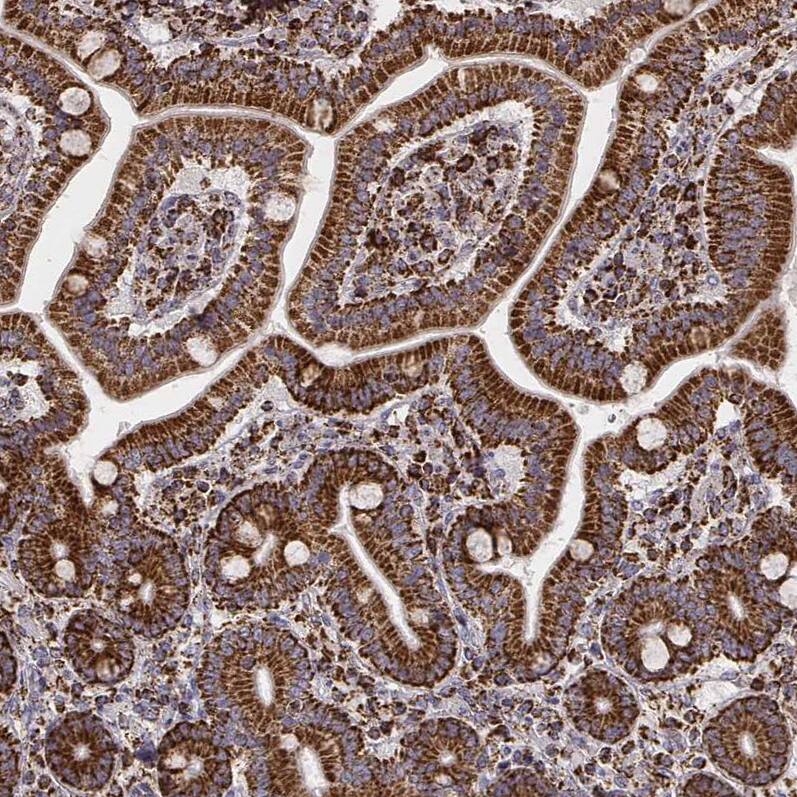 TUFM Antibody (CL2242) - Azide and BSA Free Immunohistochemistry-Paraffin: TUFM Antibody [NBP3-44455]