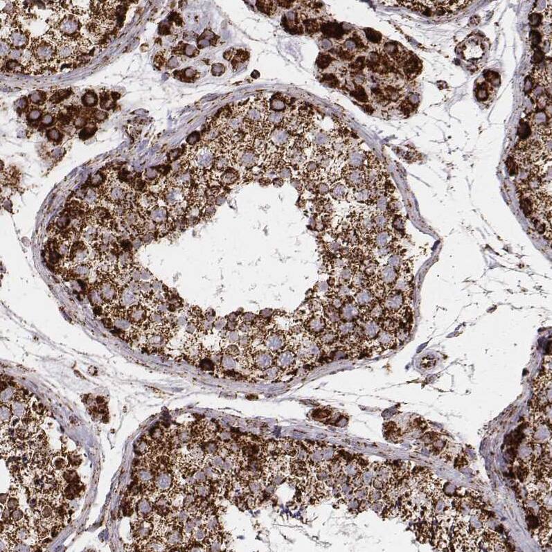 TUFM Antibody (CL2242) - Azide and BSA Free Immunohistochemistry-Paraffin: TUFM Antibody [NBP3-44455]