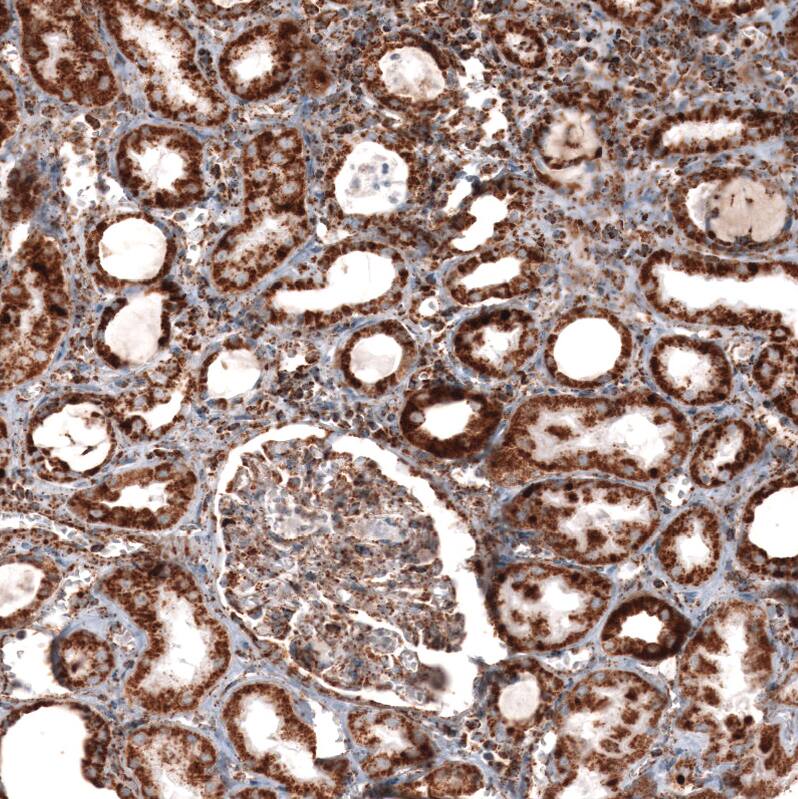 TUFM Antibody (CL2245) - Azide and BSA Free Immunohistochemistry-Paraffin: TUFM Antibody [NBP3-44457]