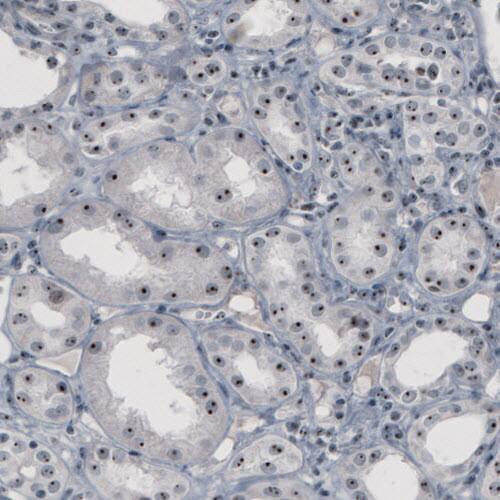 NOP56 Antibody (CL2603) - Azide and BSA Free Immunohistochemistry-Paraffin: NOP56 Antibody [NBP3-44458]