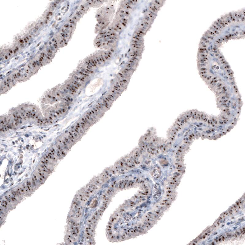 NIFK Antibody (CL2240) - Azide and BSA Free Immunohistochemistry-Paraffin: NIFK Antibody [NBP3-44459]