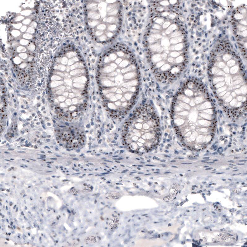 NIFK Antibody (CL2240) - Azide and BSA Free Immunohistochemistry-Paraffin: NIFK Antibody [NBP3-44459]