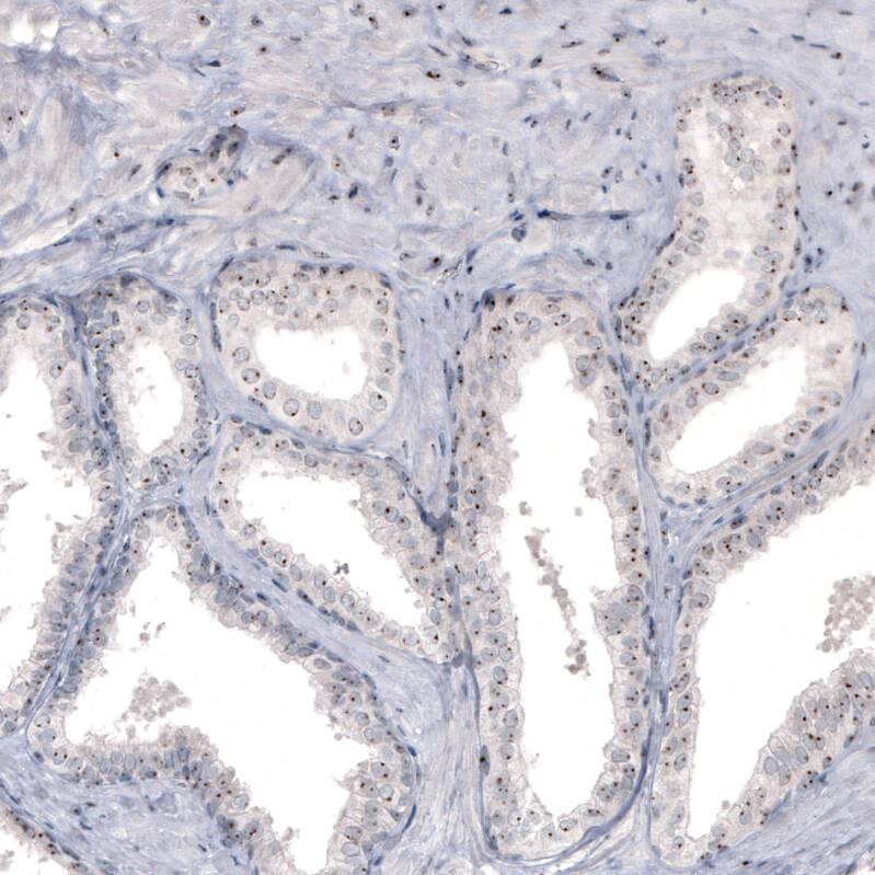 NIFK Antibody (CL2240) - Azide and BSA Free Immunohistochemistry-Paraffin: NIFK Antibody [NBP3-44459]