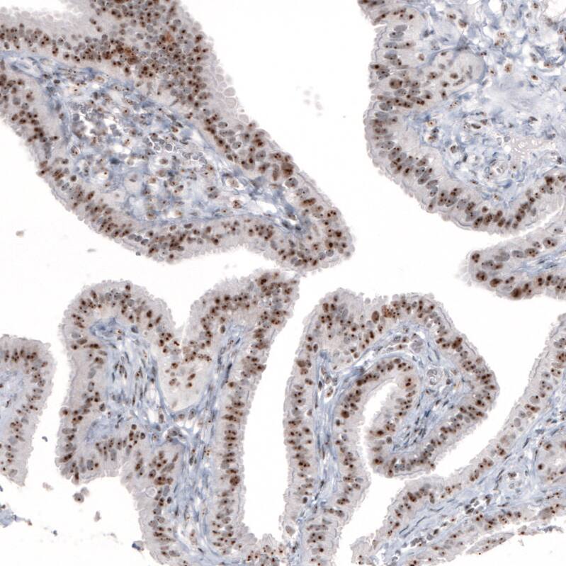 NIFK Antibody (CL2237) - Azide and BSA Free Immunohistochemistry-Paraffin: NIFK Antibody [NBP3-44460]