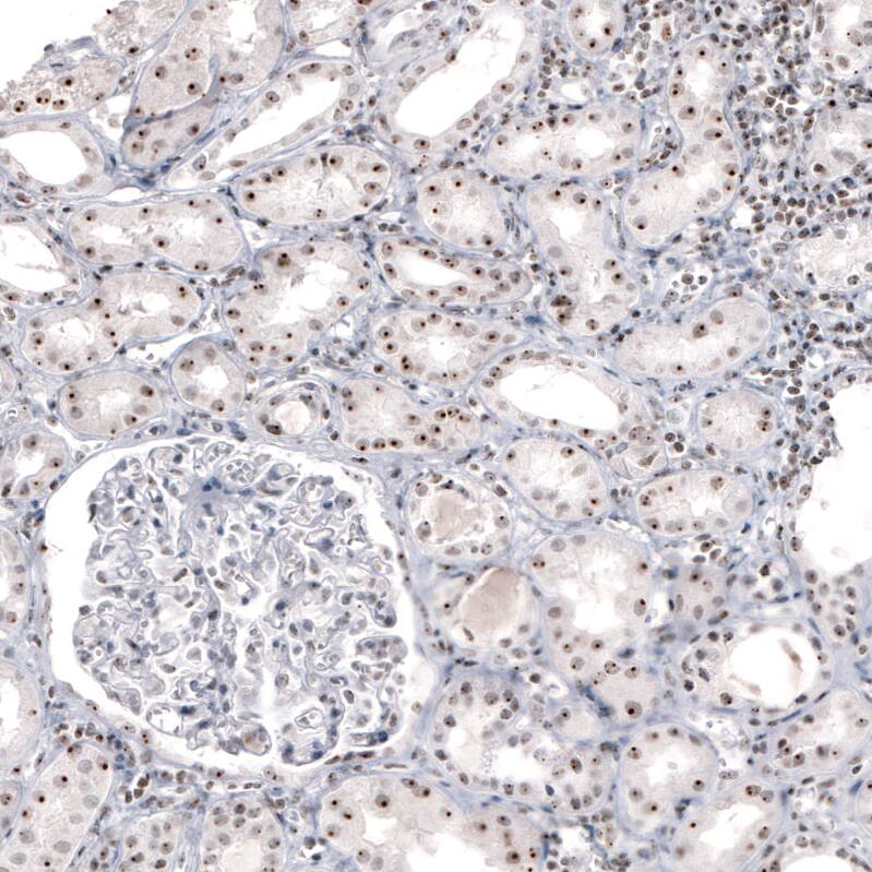 NIFK Antibody (CL2237) - Azide and BSA Free Immunohistochemistry-Paraffin: NIFK Antibody [NBP3-44460]