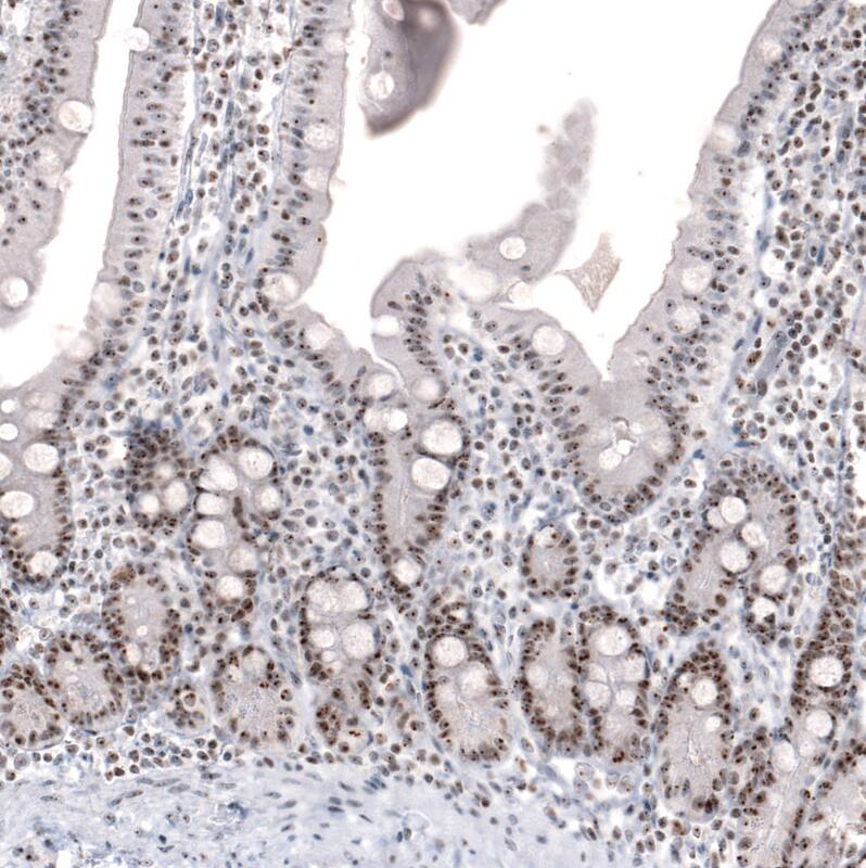 NIFK Antibody (CL2237) - Azide and BSA Free Immunohistochemistry-Paraffin: NIFK Antibody [NBP3-44460]